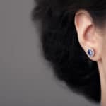 Ear Surgery / Otoplasty GA