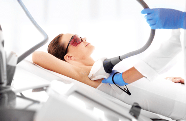 Womans underarm in laser hair removal