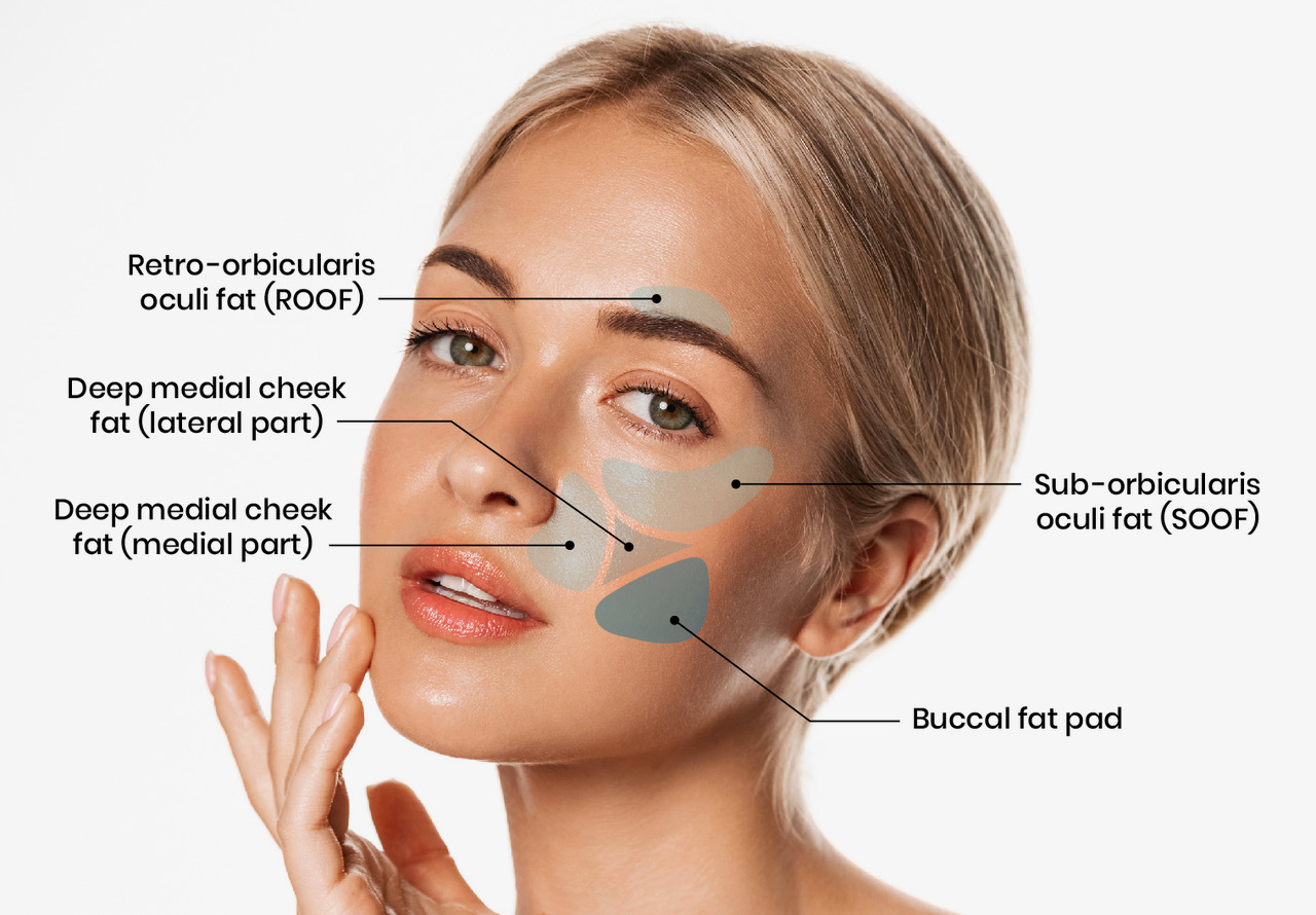 The Procedure of Buccal Pad Fat Removal